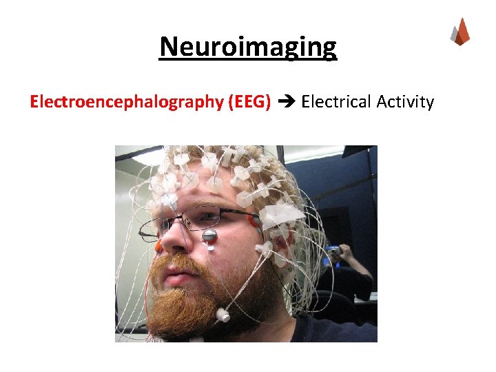 Neuroimaging Electroencephalography (EEG) Electrical Activity 