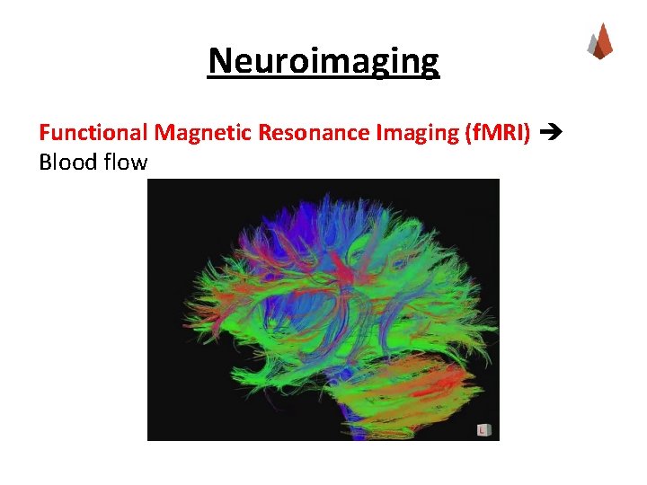 Neuroimaging Functional Magnetic Resonance Imaging (f. MRI) Blood flow 