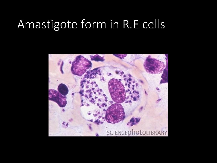 Amastigote form in R. E cells 
