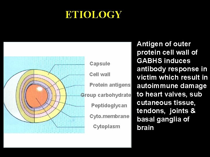ETIOLOGY Capsule Cell wall Protein antigens Group carbohydrate Peptidoglycan Cyto. membrane Cytoplasm Antigen of