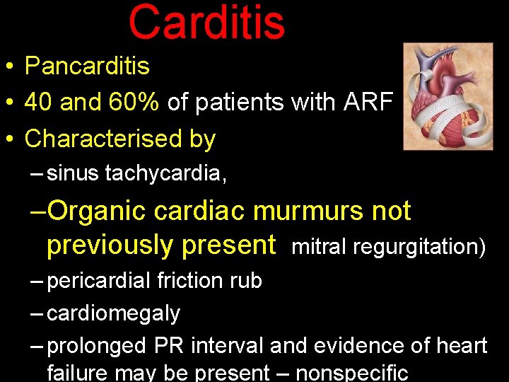 Carditis of ARF • Pancarditis • 40 and 60% of patients with ARF •