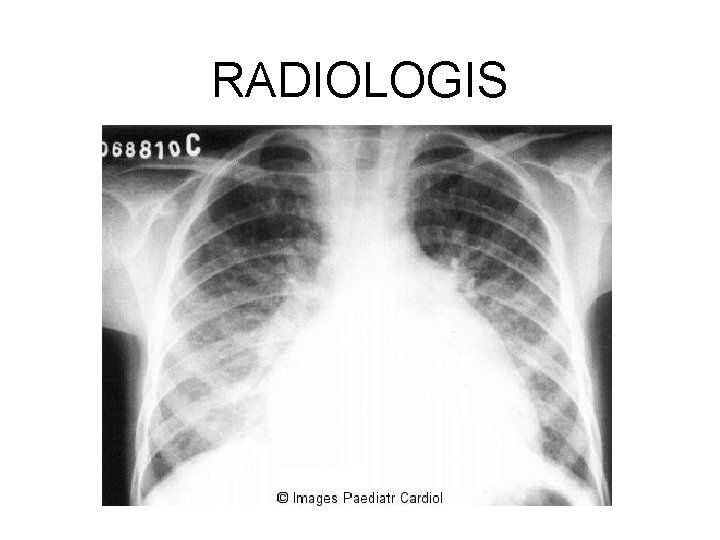 RADIOLOGIS 