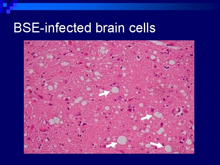 BSE-infected brain cells 