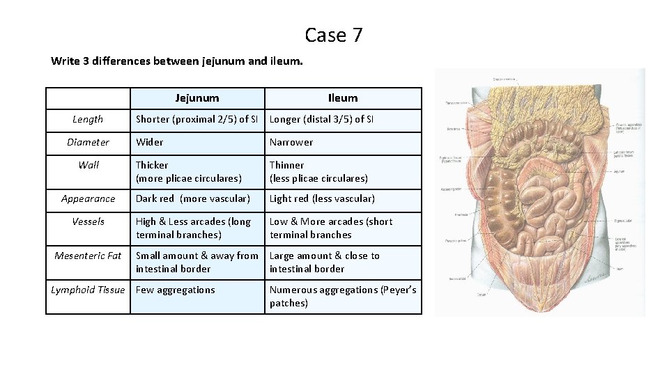 Case 7 Write 3 differences between jejunum and ileum. Jejunum Length Diameter Ileum Shorter