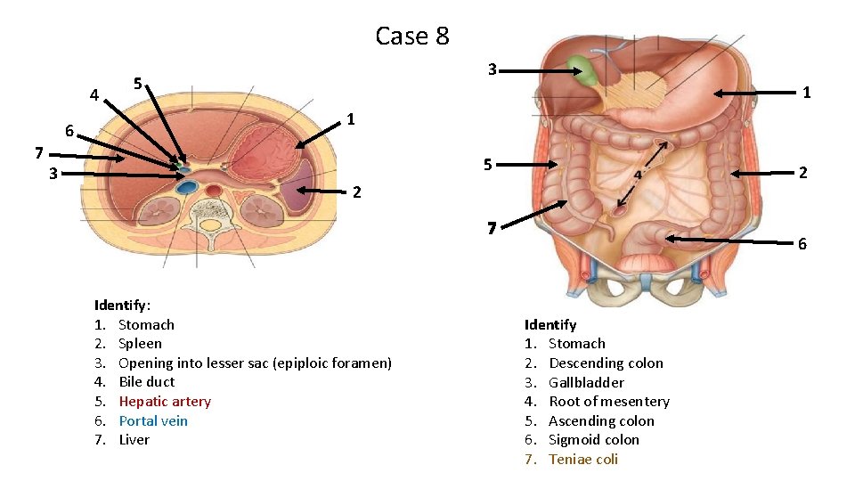 Case 8 4 6 7 3 3 5 1 1 5 2 2 7