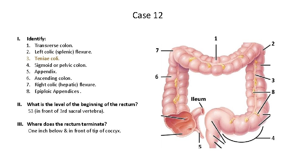 Case 12 I. Identify: 1. Transverse colon. 2. Left colic (splenic) flexure. 3. Teniae