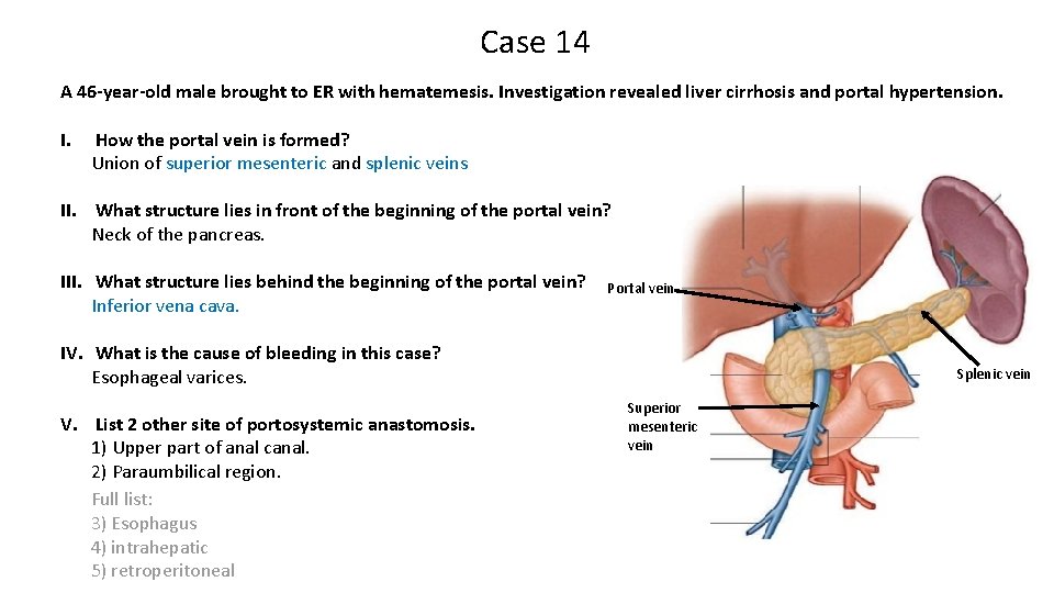 Case 14 A 46 -year-old male brought to ER with hematemesis. Investigation revealed liver