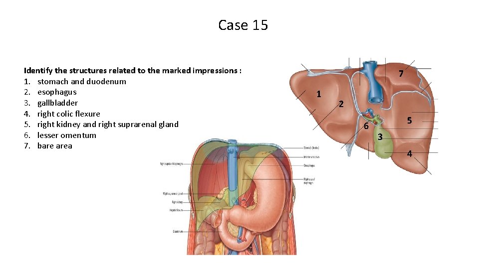 Case 15 Identify the structures related to the marked impressions : 1. stomach and