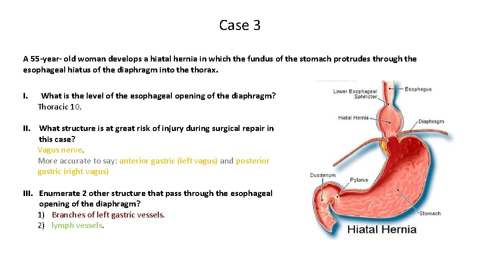 Case 3 A 55 -year- old woman develops a hiatal hernia in which the
