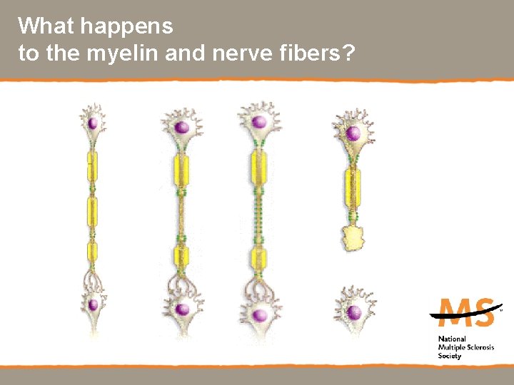 What happens to the myelin and nerve fibers? 