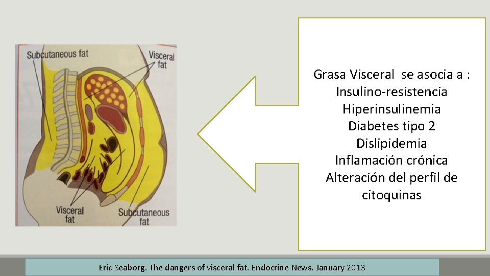 Grasa Visceral se asocia a : Insulino-resistencia Hiperinsulinemia Diabetes tipo 2 Dislipidemia Inflamación crónica