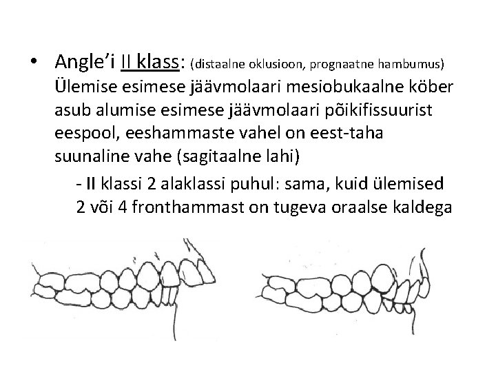  • Angle’i II klass: (distaalne oklusioon, prognaatne hambumus) Ülemise esimese jäävmolaari mesiobukaalne köber