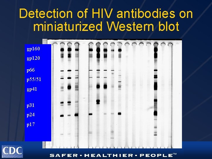 Detection of HIV antibodies on miniaturized Western blot gp 160 gp 120 p 66