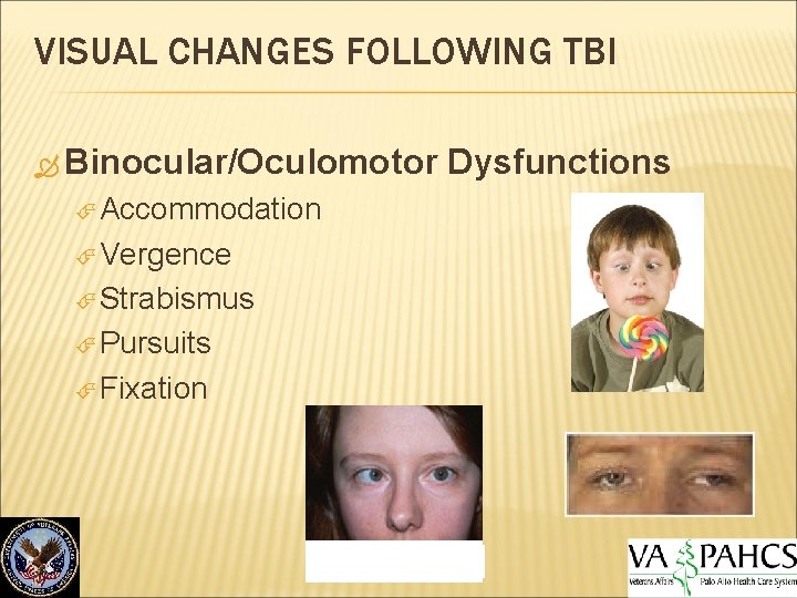 VISUAL CHANGES FOLLOWING TBI Binocular/Oculomotor Accommodation Vergence Strabismus Pursuits Fixation Dysfunctions 