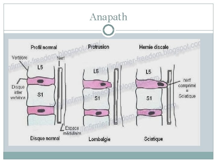 Anapath 