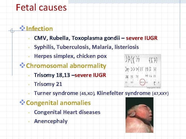 Fetal causes v. Infection § § § CMV, Rubella, Toxoplasma gondii – severe IUGR