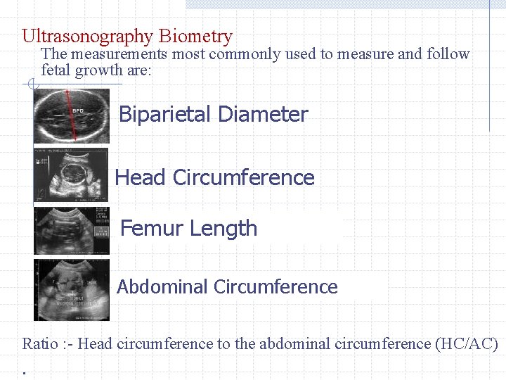 Ultrasonography Biometry The measurements most commonly used to measure and follow fetal growth are: