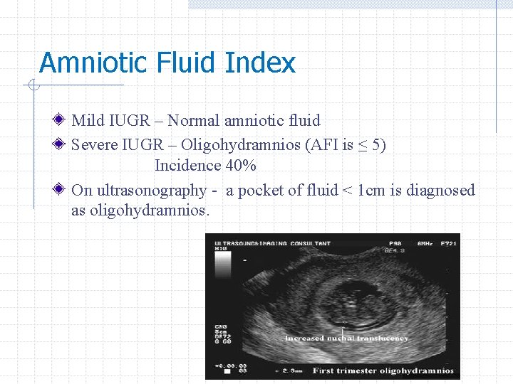 Amniotic Fluid Index Mild IUGR – Normal amniotic fluid Severe IUGR – Oligohydramnios (AFI