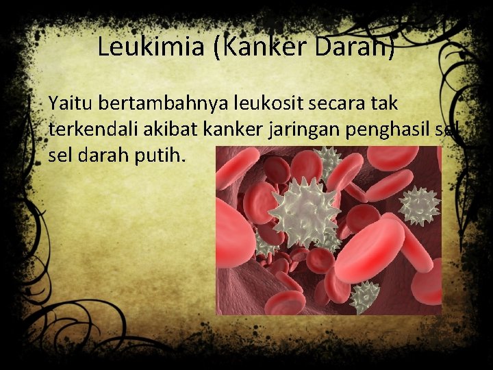 Leukimia (Kanker Darah) Yaitu bertambahnya leukosit secara tak terkendali akibat kanker jaringan penghasil sel