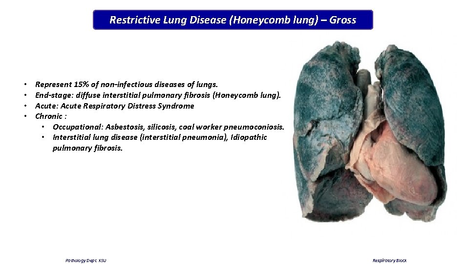 Restrictive Lung Disease (Honeycomb lung) – Gross • • Represent 15% of non-infectious diseases