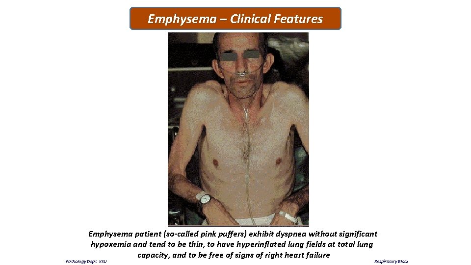 Emphysema – Clinical Features Emphysema patient (so-called pink puffers) exhibit dyspnea without significant hypoxemia
