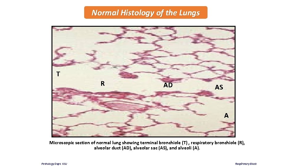 Normal Histology of the Lungs T R AD AS A Microscopic section of normal