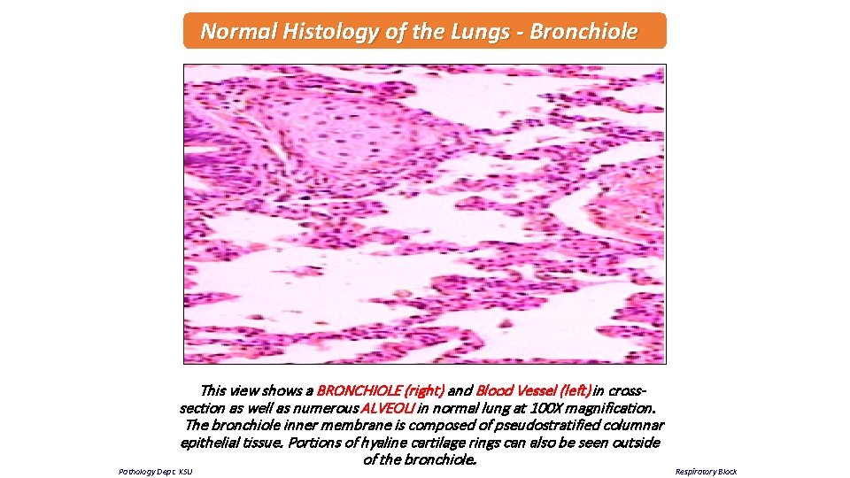 Normal Histology of the Lungs - Bronchiole This view shows a BRONCHIOLE (right) and