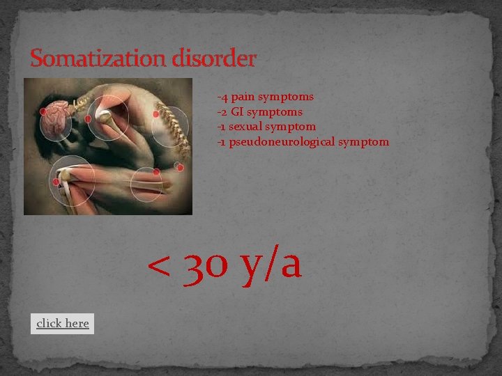 Somatization disorder -4 pain symptoms -2 GI symptoms -1 sexual symptom -1 pseudoneurological symptom
