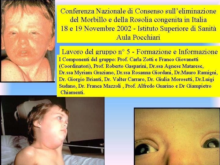 Conferenza Nazionale di Consenso sull’eliminazione del Morbillo e della Rosolia congenita in Italia 18