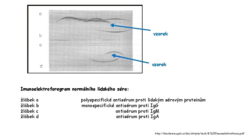 vzorek Imunoelektroforegram normálního lidského séra: žlábek a žlábek b žlábek c žlábek d polyspecifické