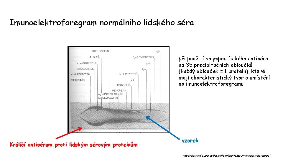 Imunoelektroforegram normálního lidského séra při použití polyspecifického antiséra až 35 precipitačních obloučků (každý oblouček