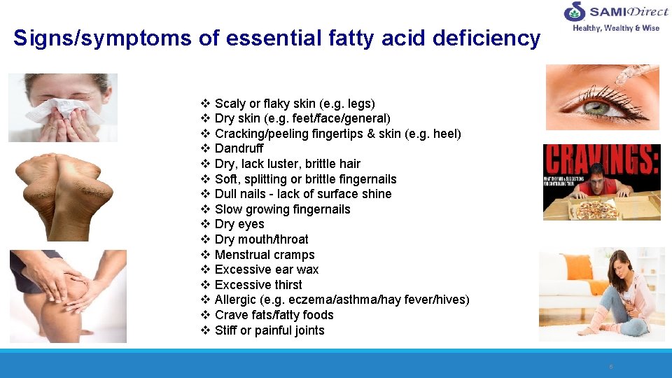 Signs/symptoms of essential fatty acid deficiency v v v v Scaly or flaky skin