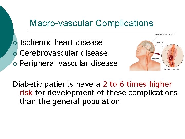 Macro-vascular Complications ¡ ¡ ¡ Ischemic heart disease Cerebrovascular disease Peripheral vascular disease Diabetic