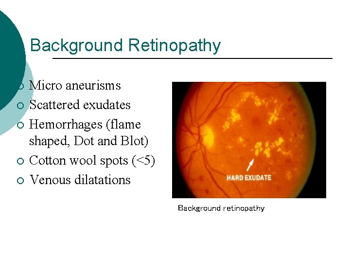 Background Retinopathy ¡ ¡ ¡ Micro aneurisms Scattered exudates Hemorrhages (flame shaped, Dot and