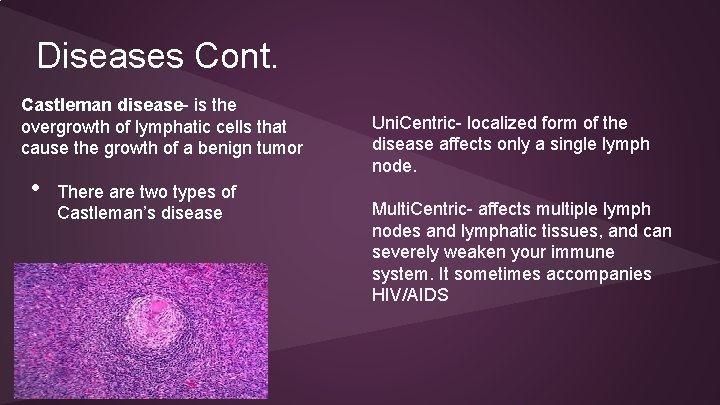 Diseases Cont. Castleman disease- is the overgrowth of lymphatic cells that cause the growth