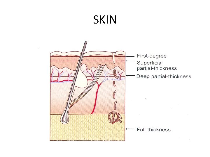 SKIN 