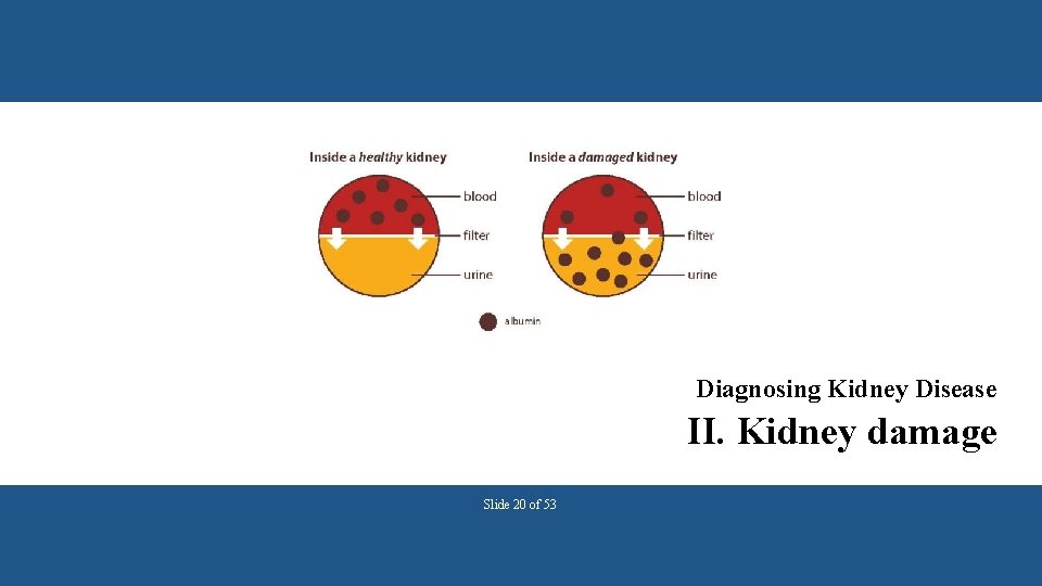 Diagnosing Kidney Disease II. Kidney damage Slide 20 of 53 