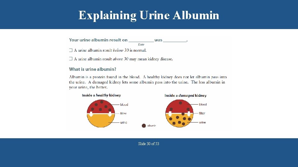 Explaining Urine Albumin Slide 30 of 53 