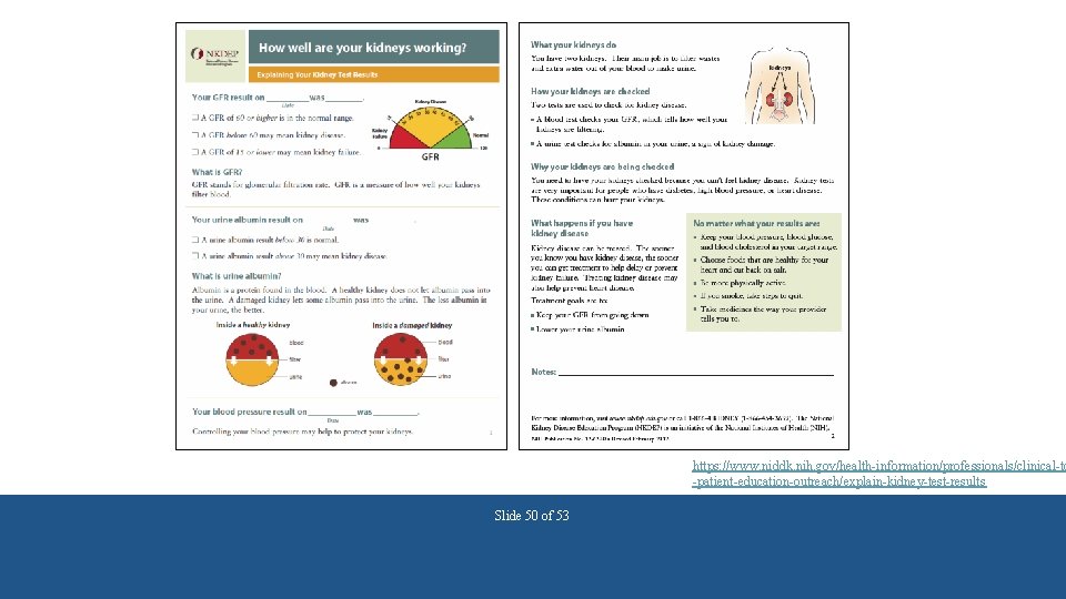 https: //www. niddk. nih. gov/health-information/professionals/clinical-to -patient-education-outreach/explain-kidney-test-results Slide 50 of 53 