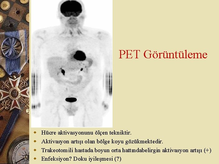 PET Görüntüleme w w Hücre aktivasyonunu ölçen tekniktir. Aktivasyon artışı olan bölge koyu gözükmektedir.