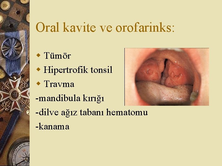 Oral kavite ve orofarinks: w Tümör w Hipertrofik tonsil w Travma -mandibula kırığı -dilve