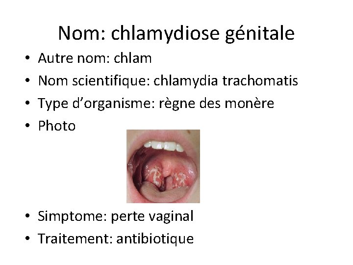 Nom: chlamydiose génitale • • Autre nom: chlam Nom scientifique: chlamydia trachomatis Type d’organisme: