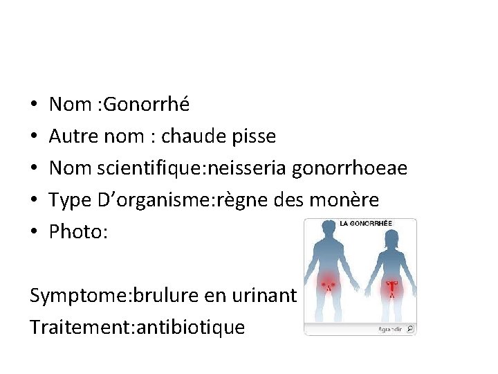  • • • Nom : Gonorrhé Autre nom : chaude pisse Nom scientifique: