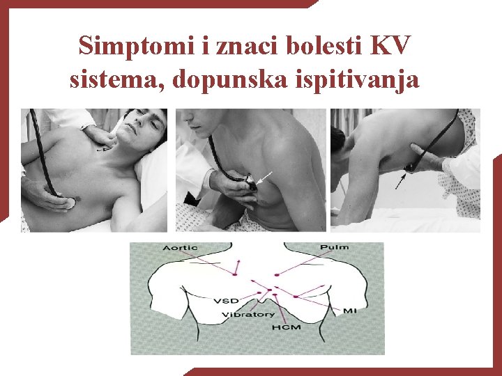 Simptomi i znaci bolesti KV sistema, dopunska ispitivanja 