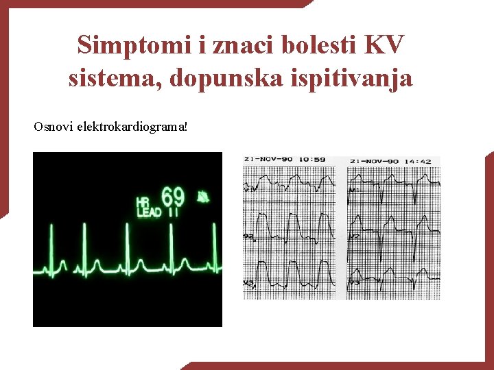 Simptomi i znaci bolesti KV sistema, dopunska ispitivanja Osnovi elektrokardiograma! 