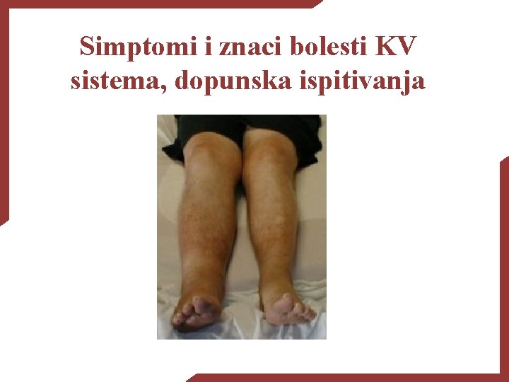 Simptomi i znaci bolesti KV sistema, dopunska ispitivanja 