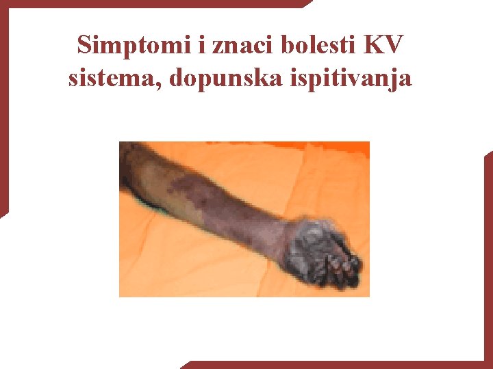 Simptomi i znaci bolesti KV sistema, dopunska ispitivanja 