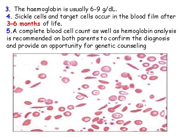 3. The haemoglobin is usually 6 -9 g/d. L. 4. Sickle cells and target