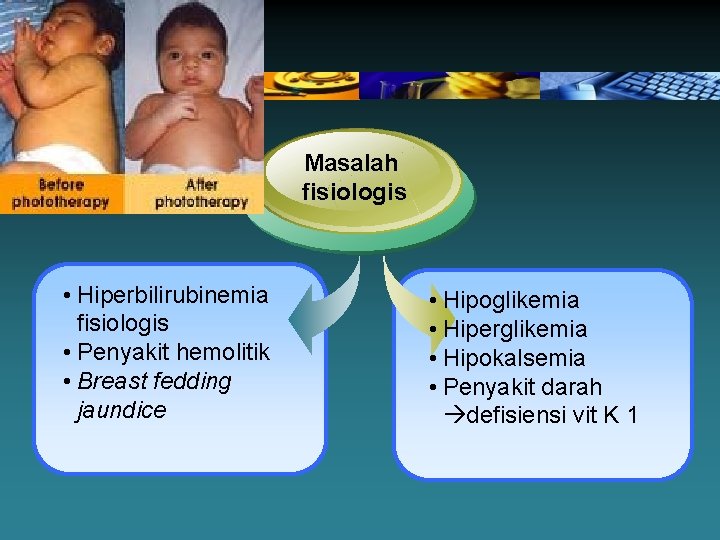 Masalah fisiologis • Hiperbilirubinemia fisiologis • Penyakit hemolitik • Breast fedding jaundice • Hipoglikemia