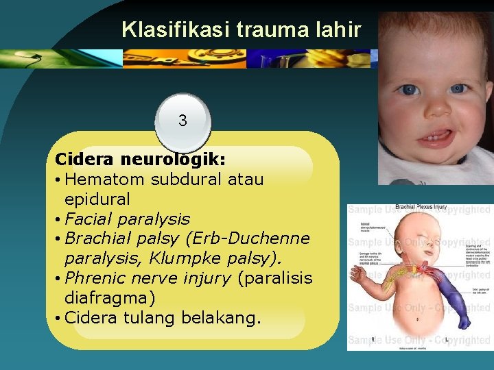 Klasifikasi trauma lahir 3 Cidera neurologik: • Hematom subdural atau epidural • Facial paralysis